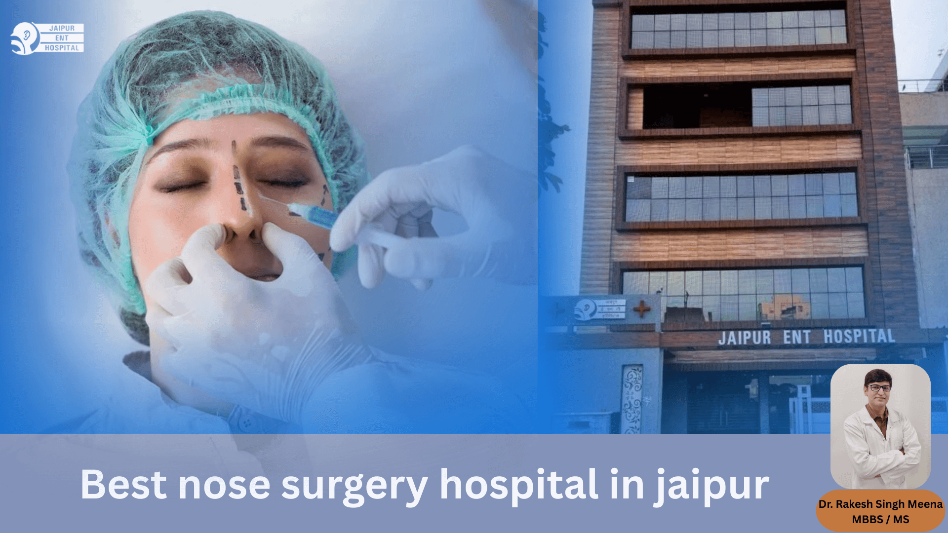 NOSE-SURGERY-ENT